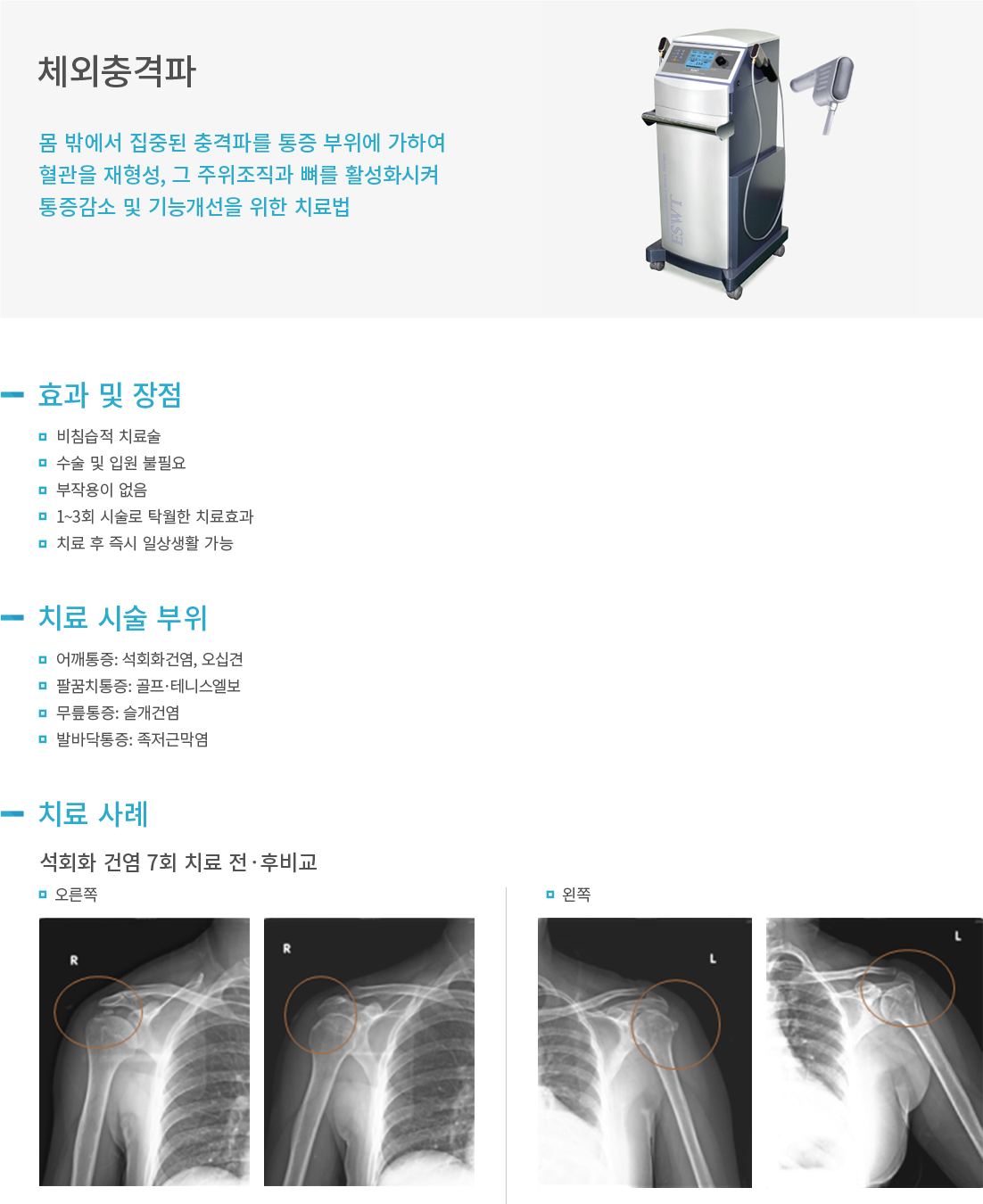 ü�������ġ��